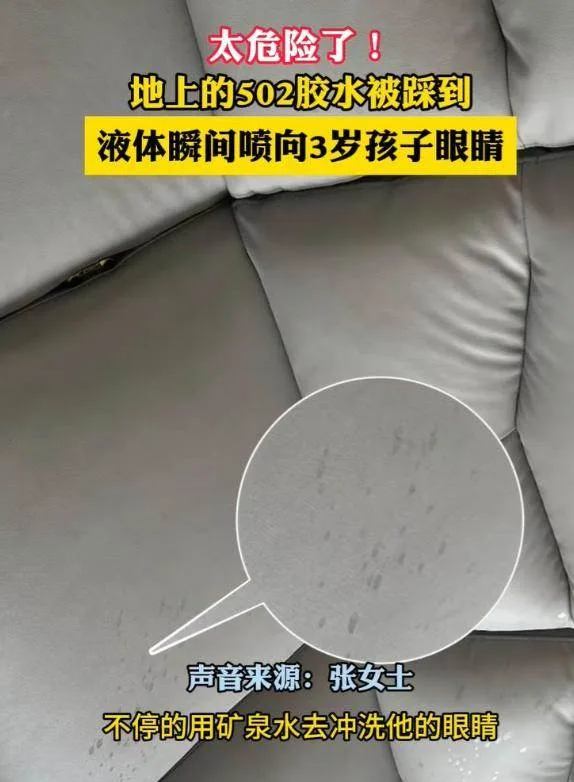 踩爆強力膠噴進孩子左眼慘被黏住 爸60秒神救援連醫生都讚教科書 第 4 張